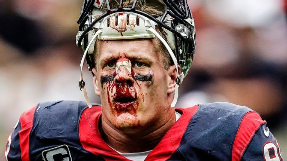 JJ Watt full of blood